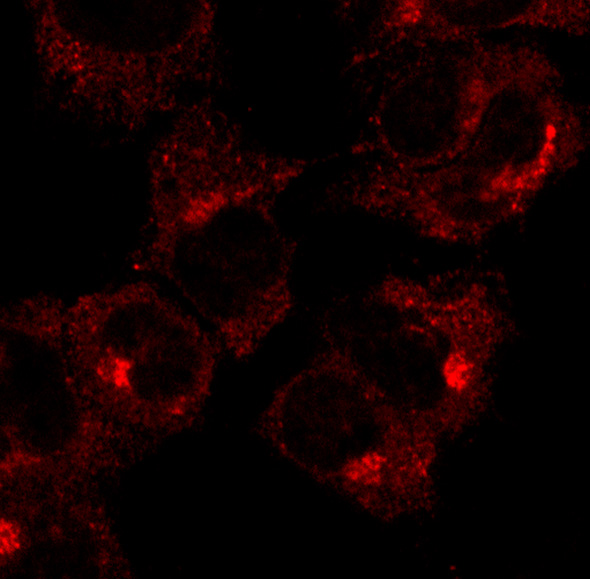 RAB1A Antibody - Immunofluorescence - anti-Rab1 antibody in COS-7 cells at 1:50 dilution. Cells were fixed with 4% of PFA.