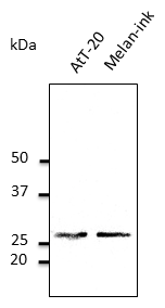 RAB27A / RAB27 Antibody - Anti-Rab27 Ab at 1:500 dilution; lysates at 50 ug per lane; rabbit polyclonal to goat IgG (HRP) at 1:10,000 dilution;