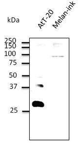 RAB27B Antibody - Western blot. Anti-Rab27b antibody at 1:500 dilution. Lysates at 100 ug per lane. Rabbit polyclonal to goat IgG (HRP) at 1:10000 dilution.
