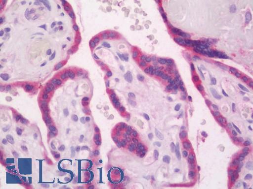 RAB27B Antibody - Human Placenta: Formalin-Fixed, Paraffin-Embedded (FFPE)