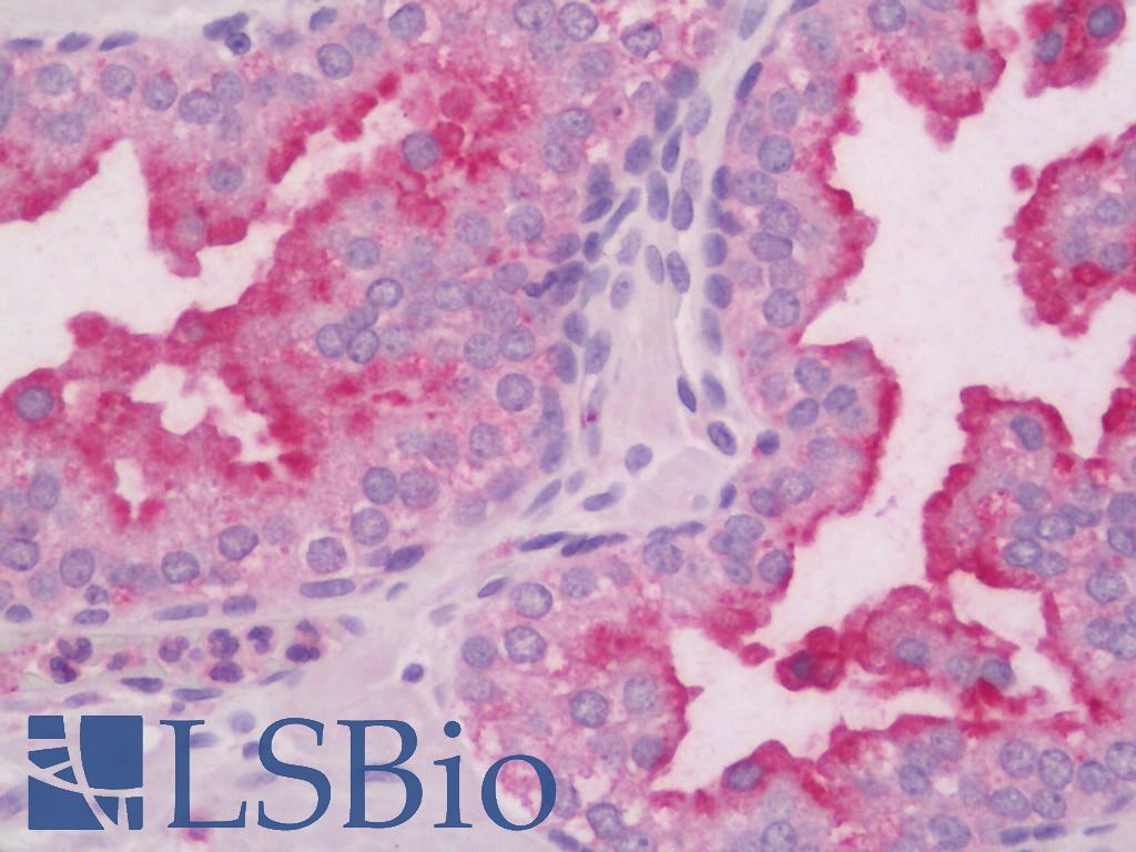 RAB27B Antibody - Human Prostate: Formalin-Fixed, Paraffin-Embedded (FFPE)