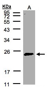 RAB2A / RAB2 Antibody - Sample (30 ug of whole cell lysate). A: HeLa S3. 12% SDS PAGE. RAB2A / RAB2 antibody diluted at 1:500