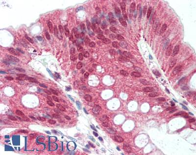 RAB2A / RAB2 Antibody - Human Colon: Formalin-Fixed, Paraffin-Embedded (FFPE), at a dilution of 1:100. 