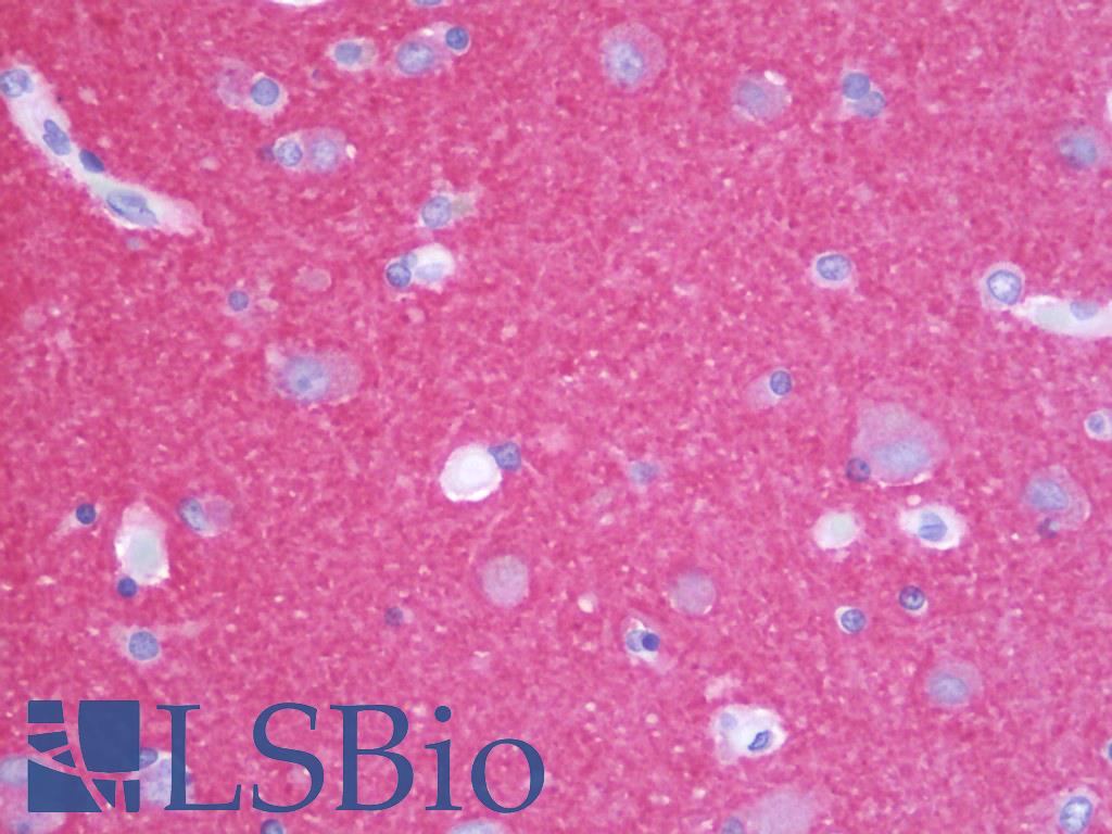 Rab3 Antibody - Anti-RAB3 antibody IHC staining of human brain, cortex. Immunohistochemistry of formalin-fixed, paraffin-embedded tissue after heat-induced antigen retrieval. Antibody concentration 5 ug/ml.