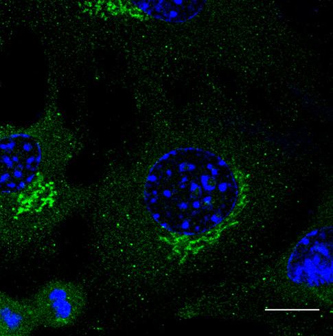 Rab3 Antibody - Immunofluorescence - anti-Rab3 antibody in B6 cells at 1:50 dilution. Cells were fixed with methanol.