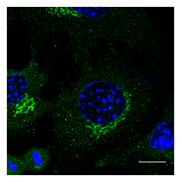 Rab3 Antibody - Immunofluorescence - anti-Rab3 Ab in B6 cells at 1:50 dilution; cells were fixed with methanol;