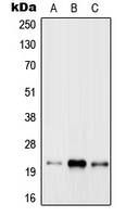 RAB31 Antibody - Western blot analysis of RAB31 expression in MCF7 (A); Raw264.7 (B); rat brain (C) whole cell lysates.
