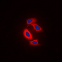 RAB31 Antibody - Immunofluorescent analysis of RAB31 staining in Raw264.7 cells. Formalin-fixed cells were permeabilized with 0.1% Triton X-100 in TBS for 5-10 minutes and blocked with 3% BSA-PBS for 30 minutes at room temperature. Cells were probed with the primary antibody in 3% BSA-PBS and incubated overnight at 4 C in a humidified chamber. Cells were washed with PBST and incubated with a DyLight 594-conjugated secondary antibody (red) in PBS at room temperature in the dark. DAPI was used to stain the cell nuclei (blue).