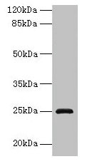 RAB32 Antibody - Western blot All lanes: RAB32 antibody at 3µg/ml + Mouse kidney tissue Secondary Goat polyclonal to rabbit IgG at 1/10000 dilution Predicted band size: 25 kDa Observed band size: 25 kDa