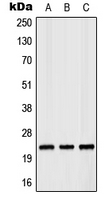 RAB35 Antibody - Western blot analysis of RAB35 expression in MCF7 (A); Raw264.7 (B); PC12 (C) whole cell lysates.