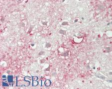 RAB35 Antibody - Human Brain, Cortex: Formalin-Fixed, Paraffin-Embedded (FFPE)