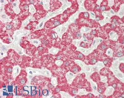 RAB35 Antibody - Human Liver: Formalin-Fixed, Paraffin-Embedded (FFPE)