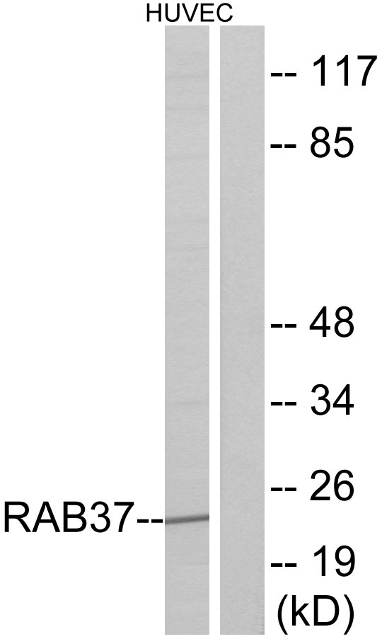 RAB37 Antibody - Western blot analysis of lysates from HUVEC cells, using RAB37 Antibody. The lane on the right is blocked with the synthesized peptide.