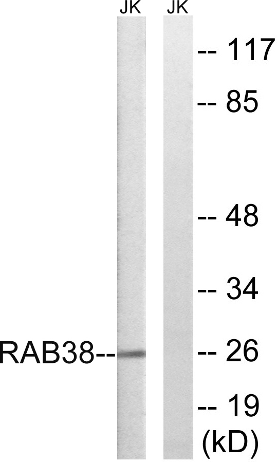RAB38 Antibody - Western blot analysis of lysates from Jurkat cells, using RAB38 Antibody. The lane on the right is blocked with the synthesized peptide.