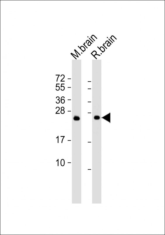 RAB3A Antibody - All lanes: Anti-RAB3A Antibody at 1:2000 dilution. Lane 1: mouse brain lysate. Lane 2: rat brain lysate Lysates/proteins at 20 ug per lane. Secondary Goat Anti-mouse IgG, (H+L), Peroxidase conjugated at 1:10000 dilution. Predicted band size: 25 kDa. Blocking/Dilution buffer: 5% NFDM/TBST.