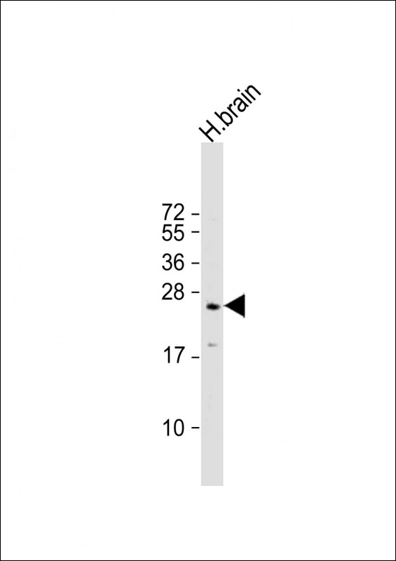 RAB3A Antibody - Anti-RAB3A Antibody at 1:500 dilution + human brain lysate Lysates/proteins at 20 ug per lane. Secondary Goat Anti-mouse IgG, (H+L), Peroxidase conjugated at 1:10000 dilution. Predicted band size: 25 kDa. Blocking/Dilution buffer: 5% NFDM/TBST.