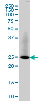 RAB3B Antibody - RAB3B monoclonal antibody (M01), clone 3F12. Western blot of RAB3B expression in IMR-32.