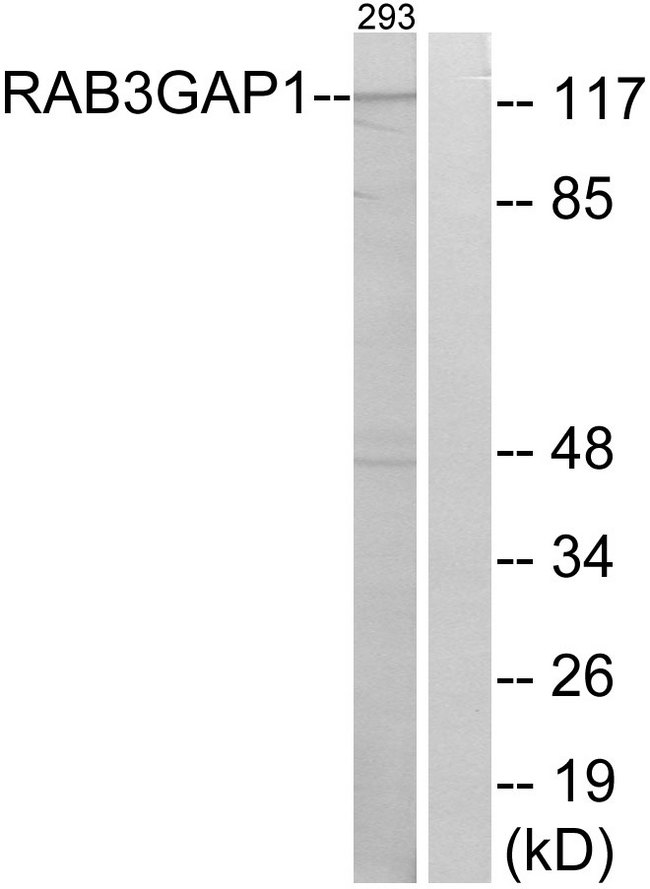 RAB3GAP1 Antibody - Western blot analysis of lysates from 293 cells, using RAB3GAP1 Antibody. The lane on the right is blocked with the synthesized peptide.