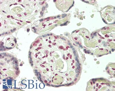 RAB3IP / RABIN3 Antibody - Human Placenta: Formalin-Fixed, Paraffin-Embedded (FFPE)
