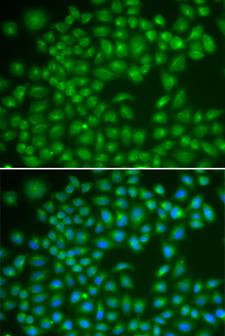 RAB4A / RAB4 Antibody - Immunofluorescence analysis of MCF-7 cell using RAB4A antibody. Blue: DAPI for nuclear staining.