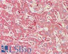 RAB4A / RAB4 Antibody - Human Liver: Formalin-Fixed, Paraffin-Embedded (FFPE)