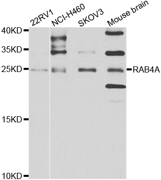RAB4A / RAB4 Antibody - Western blot analysis of extracts of various cell lines.