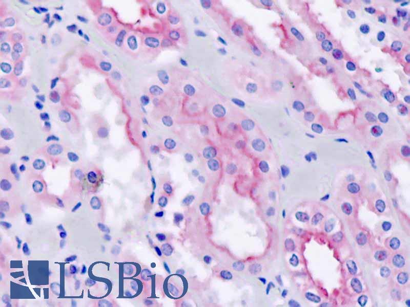 RAB4B Antibody - Human, Kidney: Formalin-Fixed Paraffin-Embedded (FFPE)