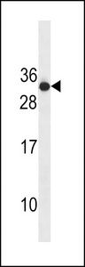 RAB4B Antibody - RAB4B Antibody western blot of CEM cell line lysates (35 ug/lane). The RAB4B antibody detected the RAB4B protein (arrow).