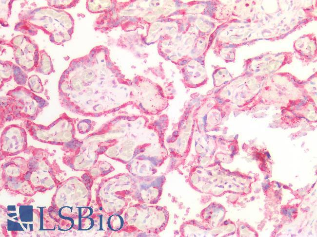 RAB5A / RAB5 Antibody - Human Placenta: Formalin-Fixed, Paraffin-Embedded (FFPE)