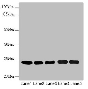 RAB5B Antibody - Western blot All Lanes RAB5B antibody at 5.16ug/ml Lane 1 : A431 whole cell lysate Lane 2 : Hela whole cell lysate Lane 3 : Jurkat whole cell lysate Lane 4 : 293T whole cell lysate Lane 5 : HepG-2 whole cell lysate Secondary Goat polyclonal to Rabbit IgG at 1/10000 dilution Predicted band size: 24,20 kDa Observed band size: 24 kDa