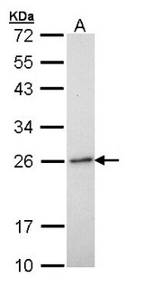 RAB6A / RAB6 Antibody - Sample (30 ug of whole cell lysate). A: H1299. 12% SDS PAGE. RAB6 antibody diluted at 1:1000.