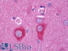 RAB6A / RAB6 Antibody - Anti-RAB6A / RAB6 antibody IHC staining of human brain, cortex. Immunohistochemistry of formalin-fixed, paraffin-embedded tissue after heat-induced antigen retrieval. Antibody concentration 7.5 ug/ml.