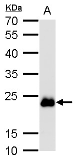 RAB6A / RAB6 Antibody - Sample (50 ug of whole cell lysate). A: Mouse brain lysate/extract. 12% SDS PAGE. RAB6 antibody diluted at 1:1000.