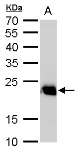 RAB6A / RAB6 Antibody - Sample (50 ug of whole cell lysate). A: Rat brain lysate/extract. 12% SDS PAGE. RAB6 antibody diluted at 1:1000.