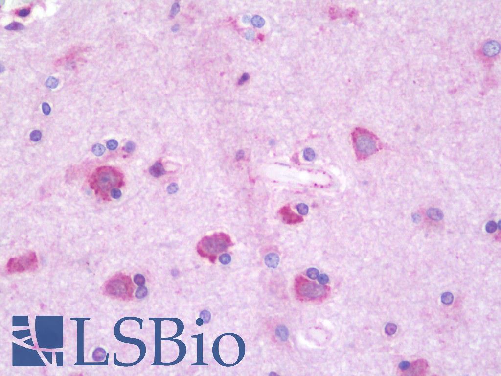 RAB6C Antibody - Anti-RAB6C antibody IHC staining of human brain, cortex. Immunohistochemistry of formalin-fixed, paraffin-embedded tissue after heat-induced antigen retrieval. Antibody dilution 1:100.
