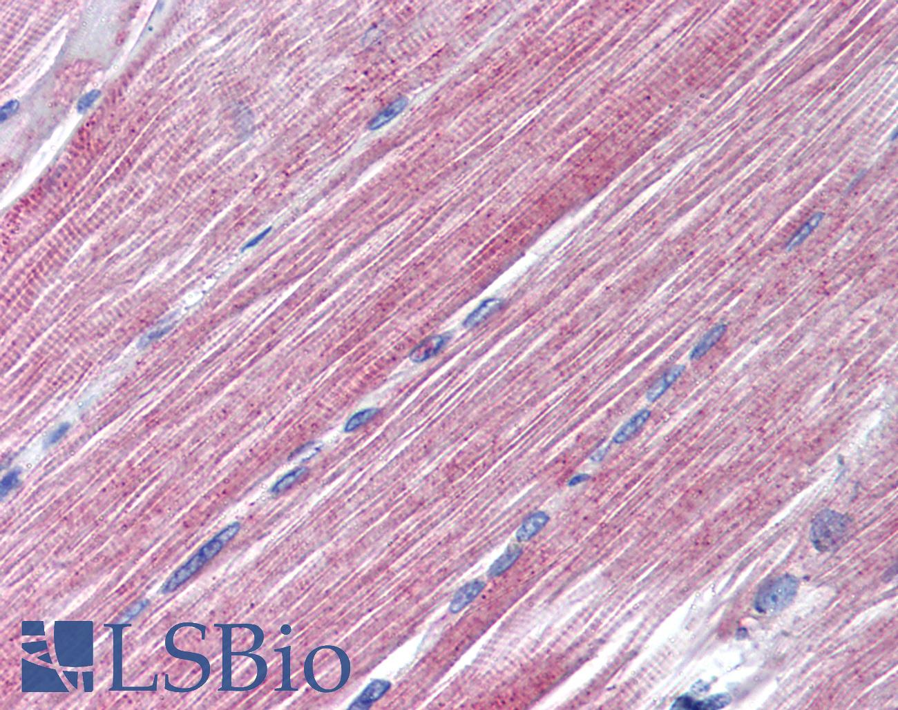 RAB7A / RAB7 Antibody - Anti-RAB7 antibody IHC of human skeletal muscle. Immunohistochemistry of formalin-fixed, paraffin-embedded tissue after heat-induced antigen retrieval. Antibody concentration 10 ug/ml.
