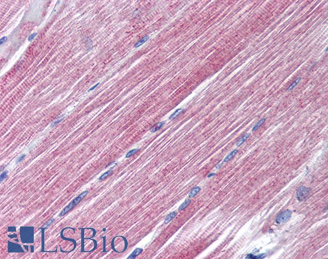 RAB7A / RAB7 Antibody - Anti-RAB7 antibody IHC of human skeletal muscle. Immunohistochemistry of formalin-fixed, paraffin-embedded tissue after heat-induced antigen retrieval. Antibody concentration 10 ug/ml.
