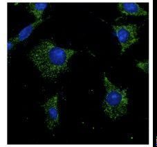 RAB7A / RAB7 Antibody - Immunofluorescence of anti-Rab7a antibody in Hepa1-6 cells at 1:50 dilution. Cells were fixed with methanol.