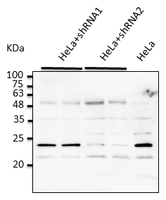 RAB7A / RAB7 Antibody - Anti-Rab7a Ab at 1:2,500 dilution; Hela cells transduced with Ad Rab7a shRNA; lysates at 50 ug per lane; rabbit polyclonal to goat IgG (HRP) at 1:10,000 dilution;