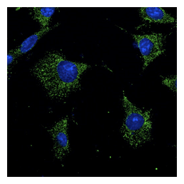 RAB7A / RAB7 Antibody - Immunofluorescence -anti-Rab7a Ab in Hepa1-6 cells at 1:50 dilution; cells were fixed with methanol;