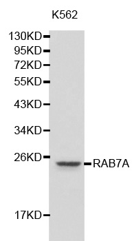RAB7A / RAB7 Antibody - Western blot analysis of extracts of K-562 cells, using RAB7A antibody. The secondary antibody used was an HRP Goat Anti-Rabbit IgG (H+L) at 1:10000 dilution. Lysates were loaded 25ug per lane and 3% nonfat dry milk in TBST was used for blocking.