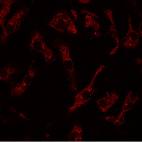 RAB8A / RAB8 Antibody - Immunofluorescence - anti-Rab8 antibody at 1:100 dilution using primary macrophages. Cells were fixed with 4% of PFA.