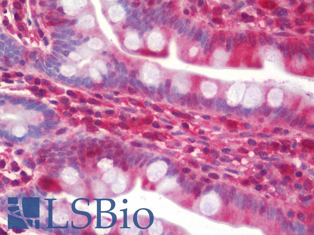 RAB8A / RAB8 Antibody - Anti-RAB8A / RAB8 antibody IHC staining of human small intestine. Immunohistochemistry of formalin-fixed, paraffin-embedded tissue after heat-induced antigen retrieval. Antibody concentration 5 ug/ml.