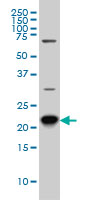 RAB8A / RAB8 Antibody - RAB8A monoclonal antibody (M02), clone 3G1 Western blot of RAB8A expression in HeLa NE.