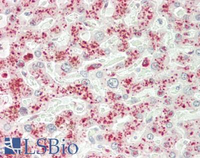 RAB8B Antibody - Human Liver: Formalin-Fixed, Paraffin-Embedded (FFPE)
