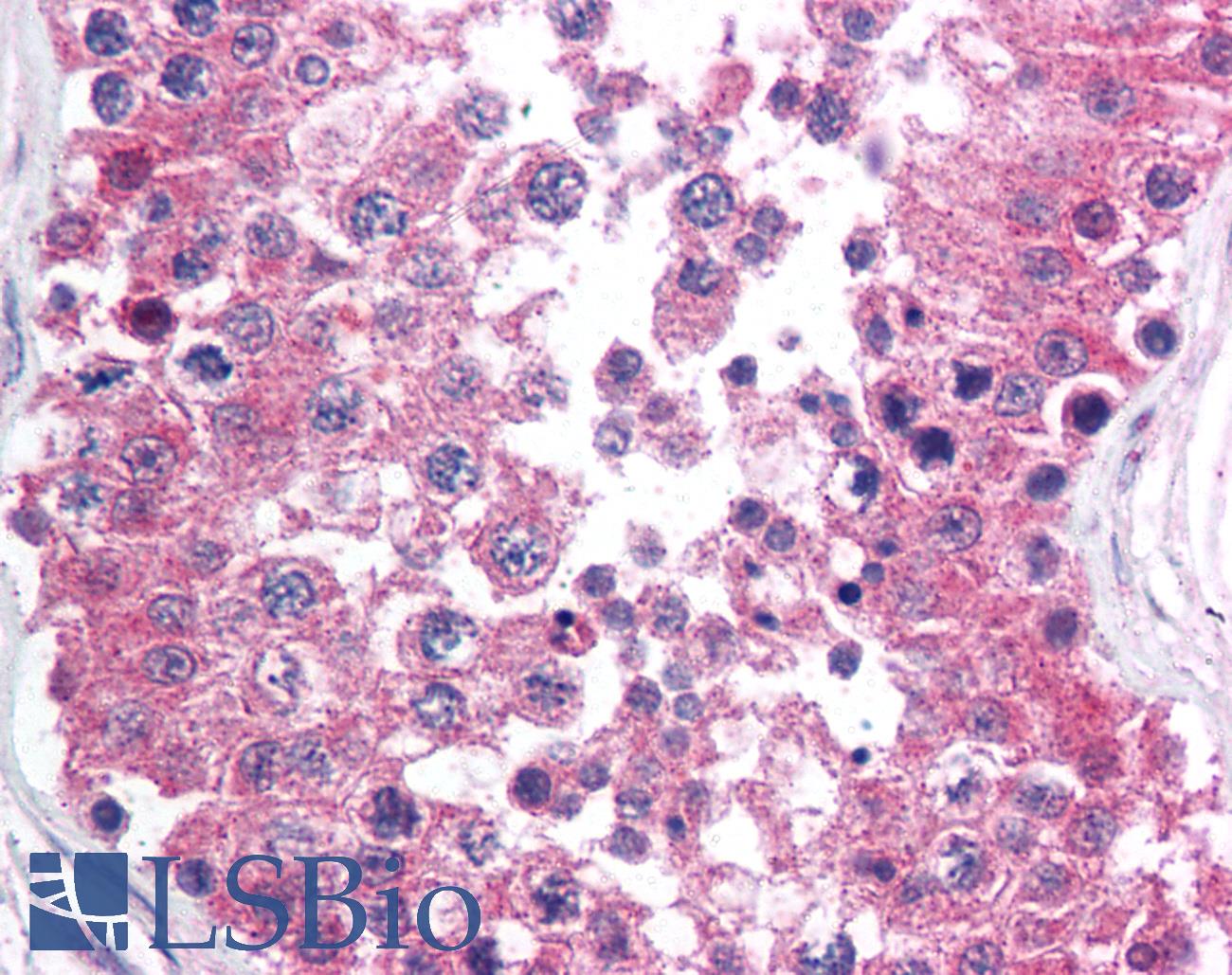 RAD1 Antibody - Anti-RAD1 antibody IHC of human testis. Immunohistochemistry of formalin-fixed, paraffin-embedded tissue after heat-induced antigen retrieval. Antibody concentration 10 ug/ml.