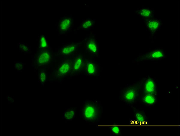 RAD18 Antibody - Immunofluorescence of monoclonal antibody to RAD18 on HeLa cell. [antibody concentration 25 ug/ml]