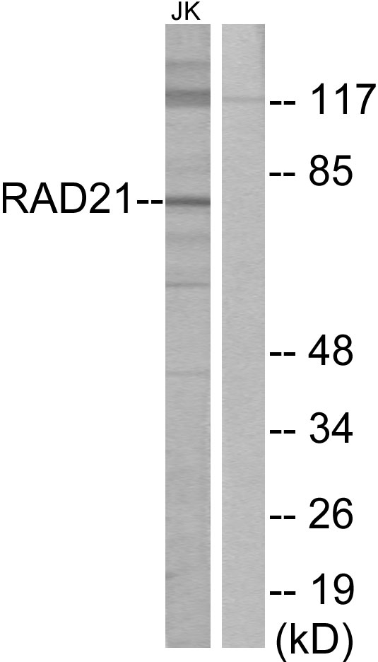RAD21 Antibody - Western blot analysis of lysates from Jurkat cells, using RAD21 Antibody. The lane on the right is blocked with the synthesized peptide.
