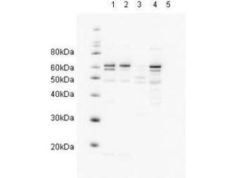 RAD23A / HHR23A Antibody - Anti-HR23A Antibody - Western Blot. Western blot showing Affinity Purified anti-HR23A antibody detects endogenous human HR23A. Reactivity is shown against HeLa nuclear extract (lane 1) and HeLa (lane 2), A431 (lane 3), Jurkat (lane 4) and 293 whole cell lysates (lane 5). Comparison to a molecular weight marker (at left) indicates a band of ~60 kD corresponding to HR23A. The blot was incubated with a 1:500 dilution of the antibody at room temperature followed by detection using HRP conjugated Rb-a-Goat IgG and chemiluminescence reagent with a 30-min exposure time. Other detection systems will yield similar results.
