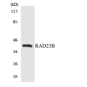 RAD23B / HR23B Antibody - Western blot analysis of the lysates from Jurkat cells using RAD23B antibody.